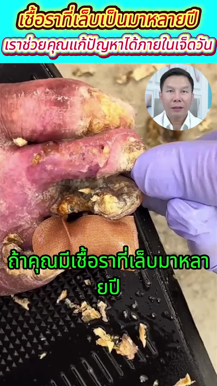 #การป้องกันและการใช้งานรายวัน โซลูชั่นดูแลเล็บ ผลิตภัณฑ์ดูแลเล็บ ส่วนผสมน้ำหนักเบา ใช้ได้ทุกที่ทุกเวลา ปริมาณ 30มล เพิ่มความหนา โซลูชั่นดูแลเล็บ