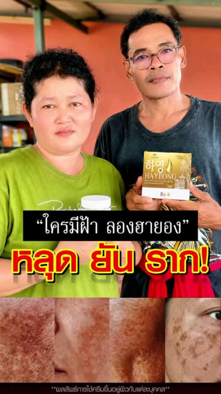 #ครีมฮายอง #ลดสิวฝ้ากระ #จุดด่างดำ #ผิวเนียน #ผิวกระจ่างใส #hayeong